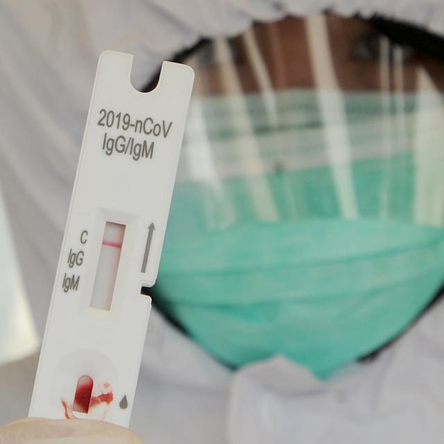 Karyawan Perusahaan Bisa Rapid Test Covid 19 Di Rumah Cek Caranya Health Liputan6 Com