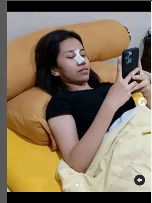 Mayang adik Vanessa Angel disebut habis operasi plastik pada bagian hidung (Foto IG dodysoedrajat_1)