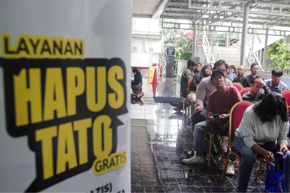 Layanan Hapus Tato Gratis di Jakarta