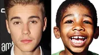 Justin Bieber Bantu Selamatkan Hidup Seorang Anak