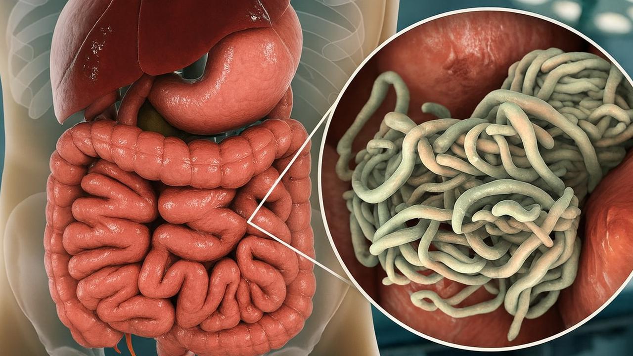 Fakta Cacing Gelang, Penyebab Meninggalnya Raya Bocah 3 Tahun Asal Sukabumi