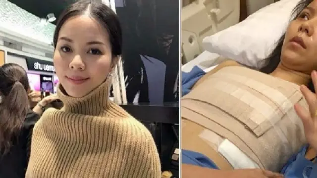 artis cantik nyaris meregang nyawa karena implan payudara (Foto: Instagram May Jeeranan Kitprasan)