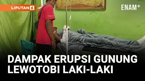 VIDEO: Dua Korban Luka Bakar Serius Dampak Erupsi Gunung Lewotobi Laki-Laki