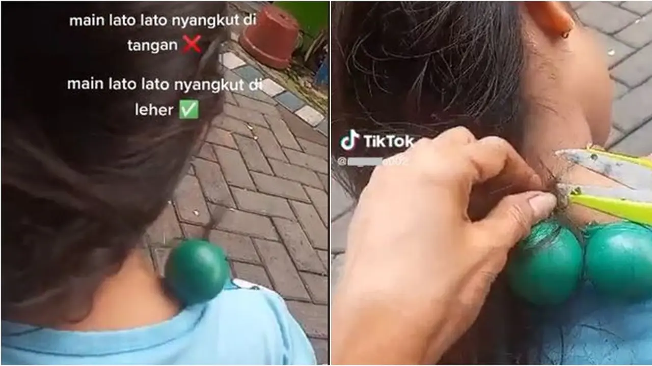 Tali Lato-lato Ini Nyangkut di Leher dan Rambut Bocah, Langsung Kena Marah Ibu