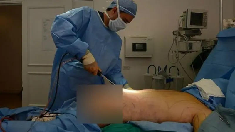Seorang dokter sedang melakukan prosedur pembesaran bokong