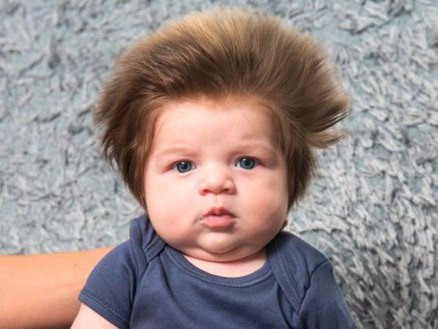 Menggemaskan Bayi Ini Punya Rambut Lebat Seperti Singa Health Liputan6 Com