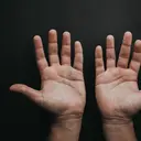 Bangun Tidur Tangan Kaku dan Bengkak? Bisa Jadi Tanda Rheumatoid Arthritis