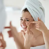 Ilustrasi masalah jerawat/copyright shutterstock