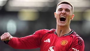 Bedanya, Sesko kali ini dipercaya oleh pelatih Michael Carrick menjadi starter. Sementara sebelumnya, ia dimainkan dari bangku cadangan. (AP Photo/PA/Martin Rickett)