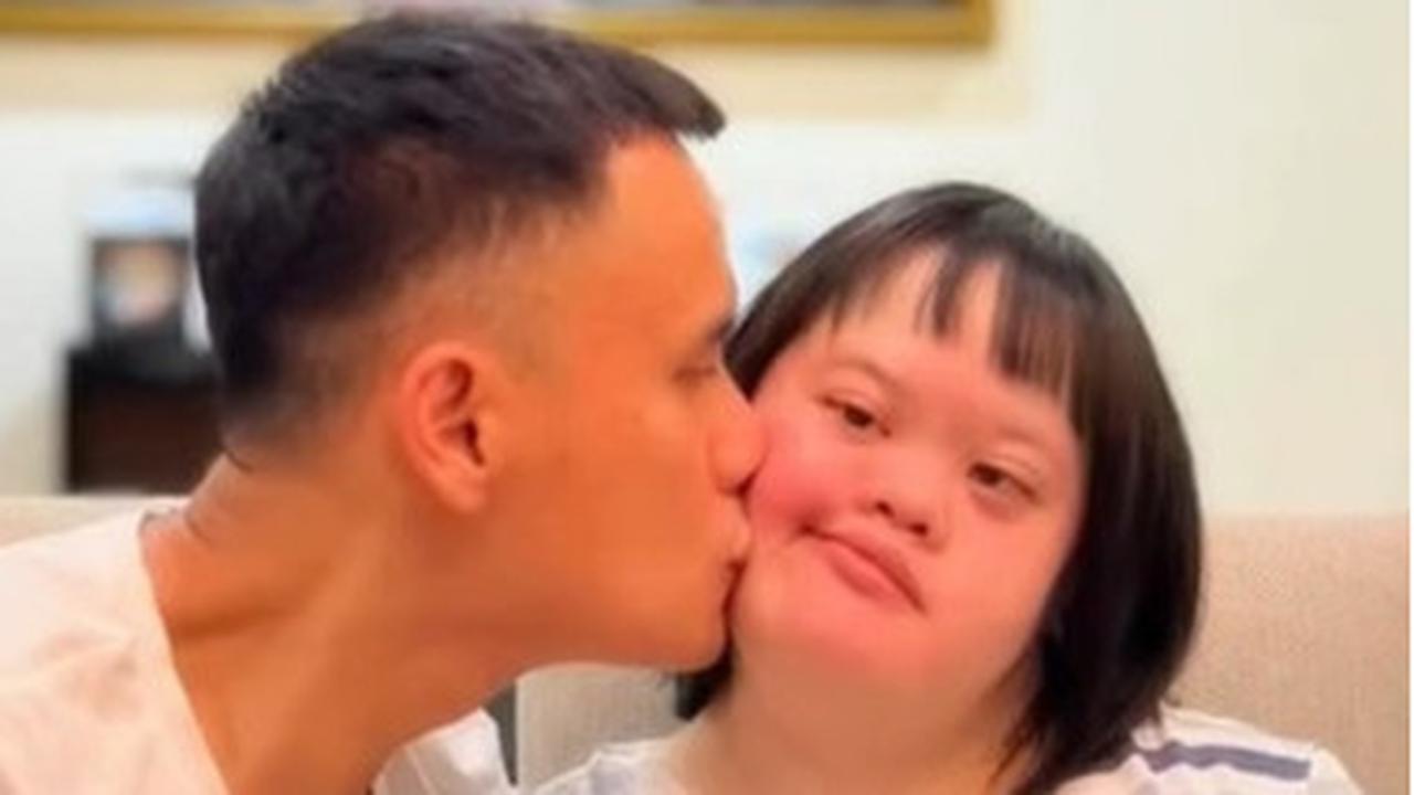 Momen Manis Choky Sitohang Beri Ucapan Ulang Tahun ke Citra Sang Adik yang Berkebutuhan Khusus, Romantisnya Bikin Netizen Terharu
