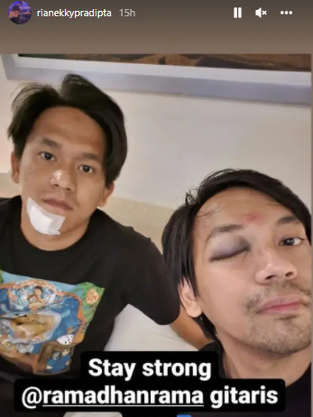 5 Potret Terkini Rian D'Masiv Usai Alami Kecelakaan, Mata Memar