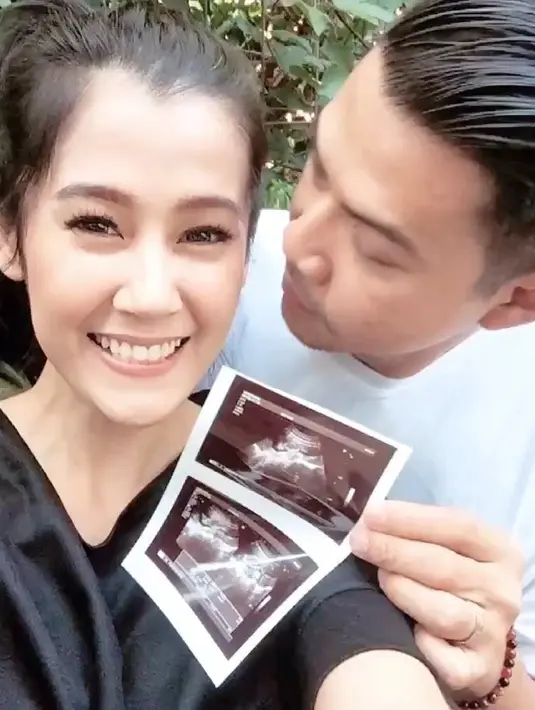 "Ternyata sudah 3 bulan. Kaget juga sih pas cek (kandungan)," kata Ardina Rasti di Epicentrum Walk, Jakarta Selatan, Senin (16/7/2018) dilansir dari Liputan6.com. (instagram/ardinarasti6)