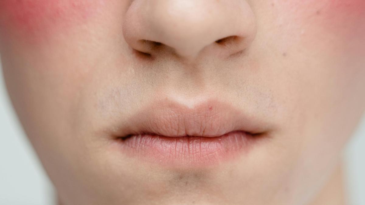 Makeup Sering Cakey? Ini Tips Makeup Anti Cakey pada Kulit Kering