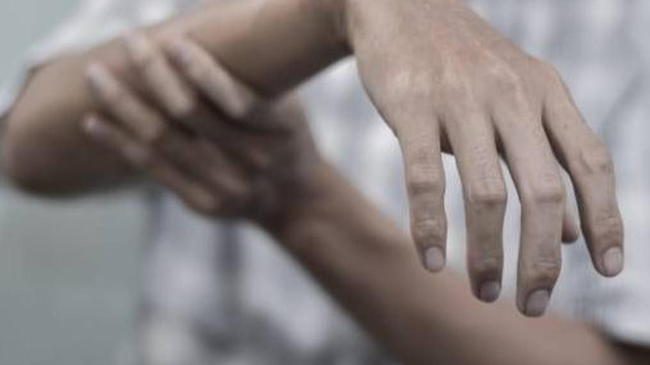 Mengenal Tardive Dyskinesia, Efek Samping Obat yang Sebabkan Gerakan Tak Terkendali
