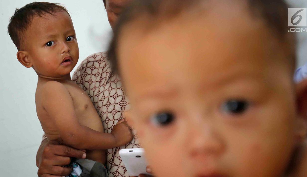 FOTO Melihat Kondisi Anak  Anak  Kurang Gizi di Pandeglang 