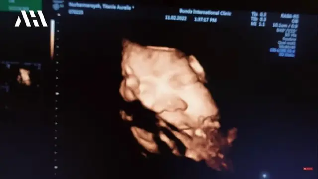 7 Momen Kompak Krisdayanti dan Ashanty Temani Aurel Hermansyah Periksa Kandungan