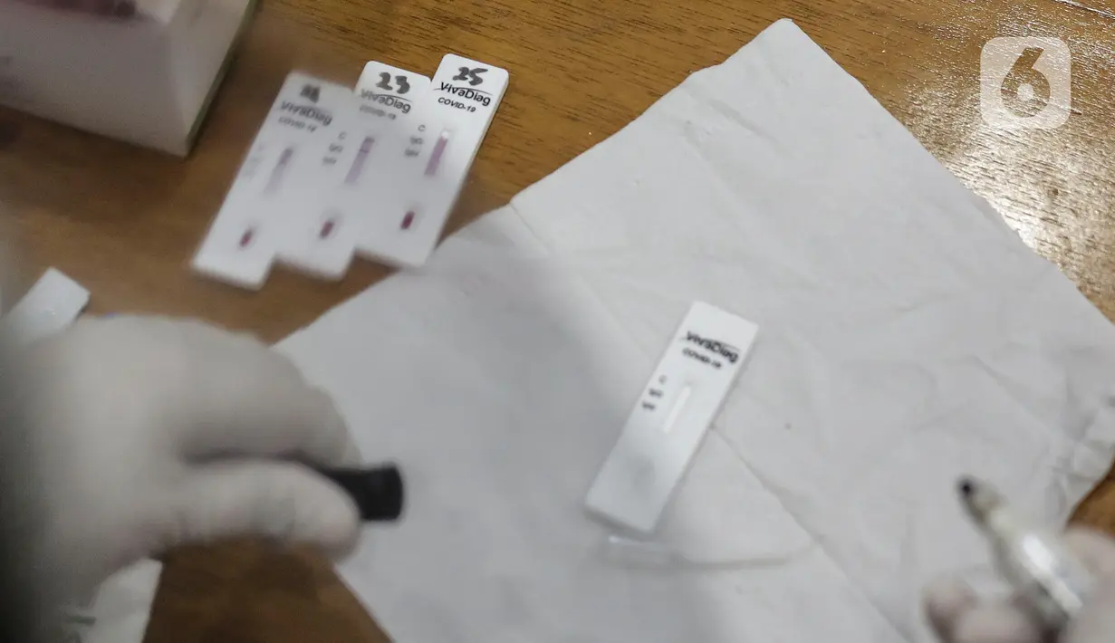Petugas medis menggelar melakukan tes diagnosa cepat (rapid test) wartawan yang bertugas di DPR, di Kompleks Parlemen, Senayan, Jakarta, Rabu (1/7/2020). Rapid test yang digelar secara gratis ini untuk mendeteksi penyebaran dan memutus mata rantai Penyebaran Covid 19. (Liputan6.com/Johan Tallo)