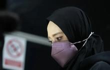 Upaya Restorative Justice Kandas, Polisi Lanjutkan Kasus Inara Rusli
