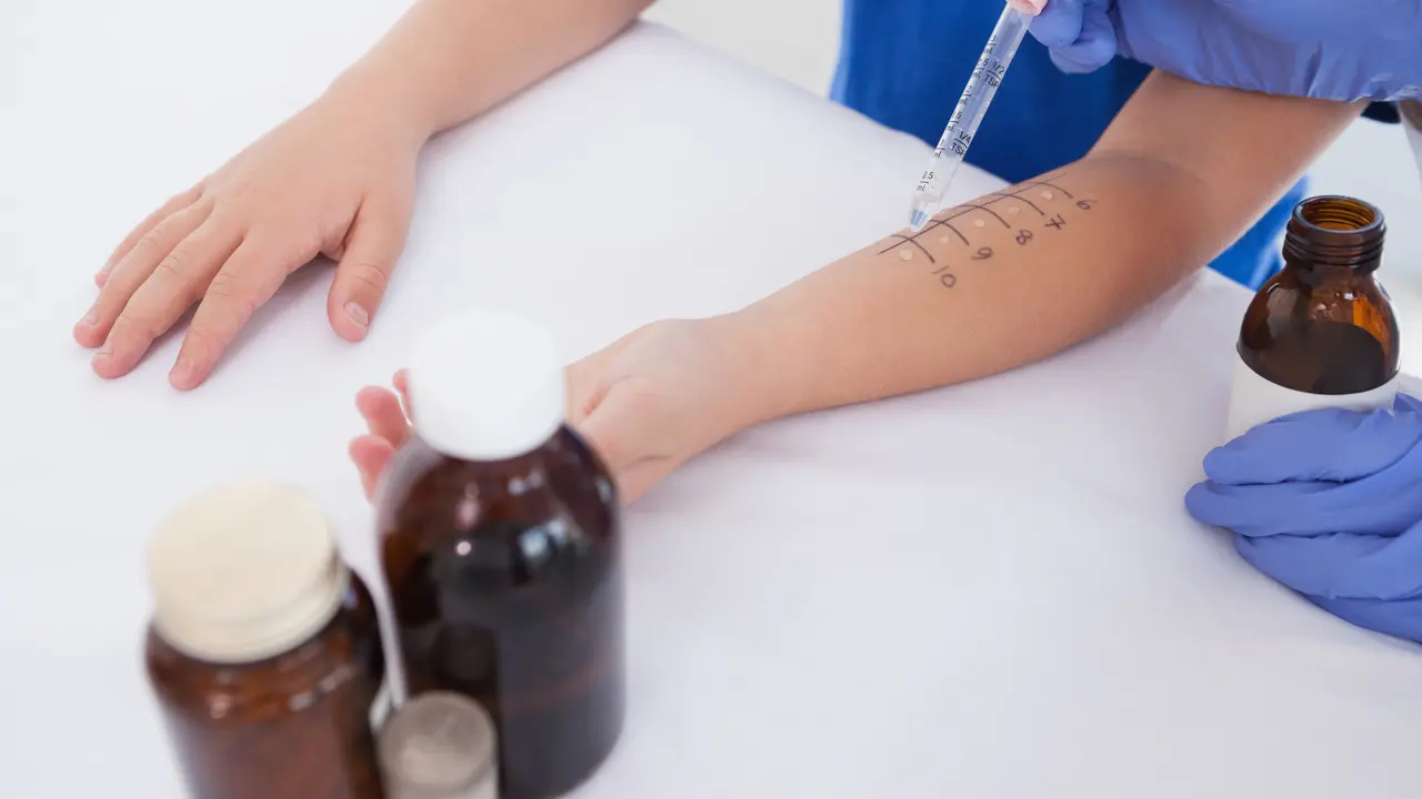 Tes alergi pada anak (iStock)