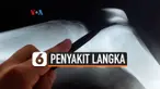 penyakit langka
