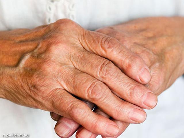 Rheumatoid Arthritis - Pemeriksaan Penunjang