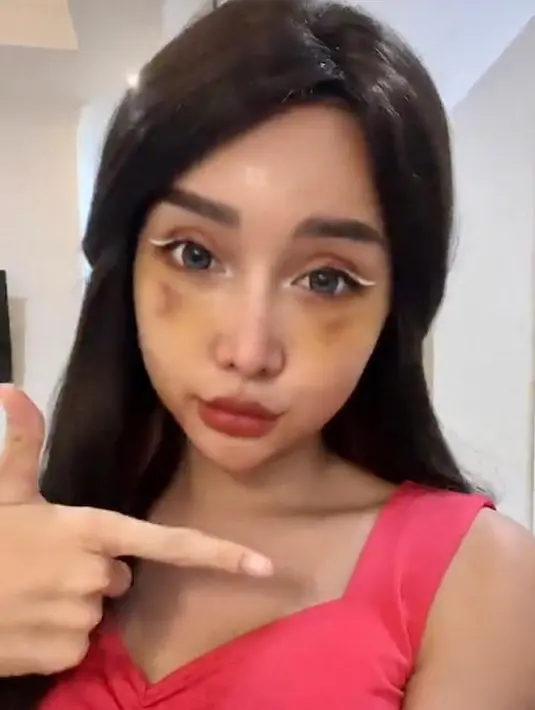 Ambisi Lucinta Luna melakukan operasi plastik tak lain ialah karena terinspirasi dari sang idola, Lisa BLACKPINK. Lucinta Luna mengaku ingin lebih mirip Lisa BLACKPINK. (Instagram/lucintaluna_manjalita)