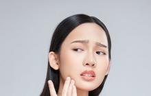Tips Jaga Kebersihan Wajah Biar Tak Gampang Jerawatan
