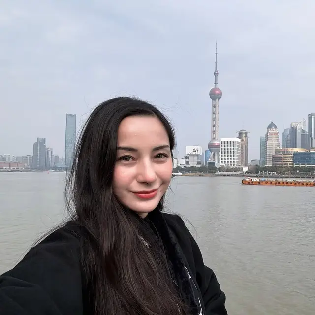 6 Potret Terbaru Kirana Larasati Usai Rhinoplasty, Akui untuk Estetika