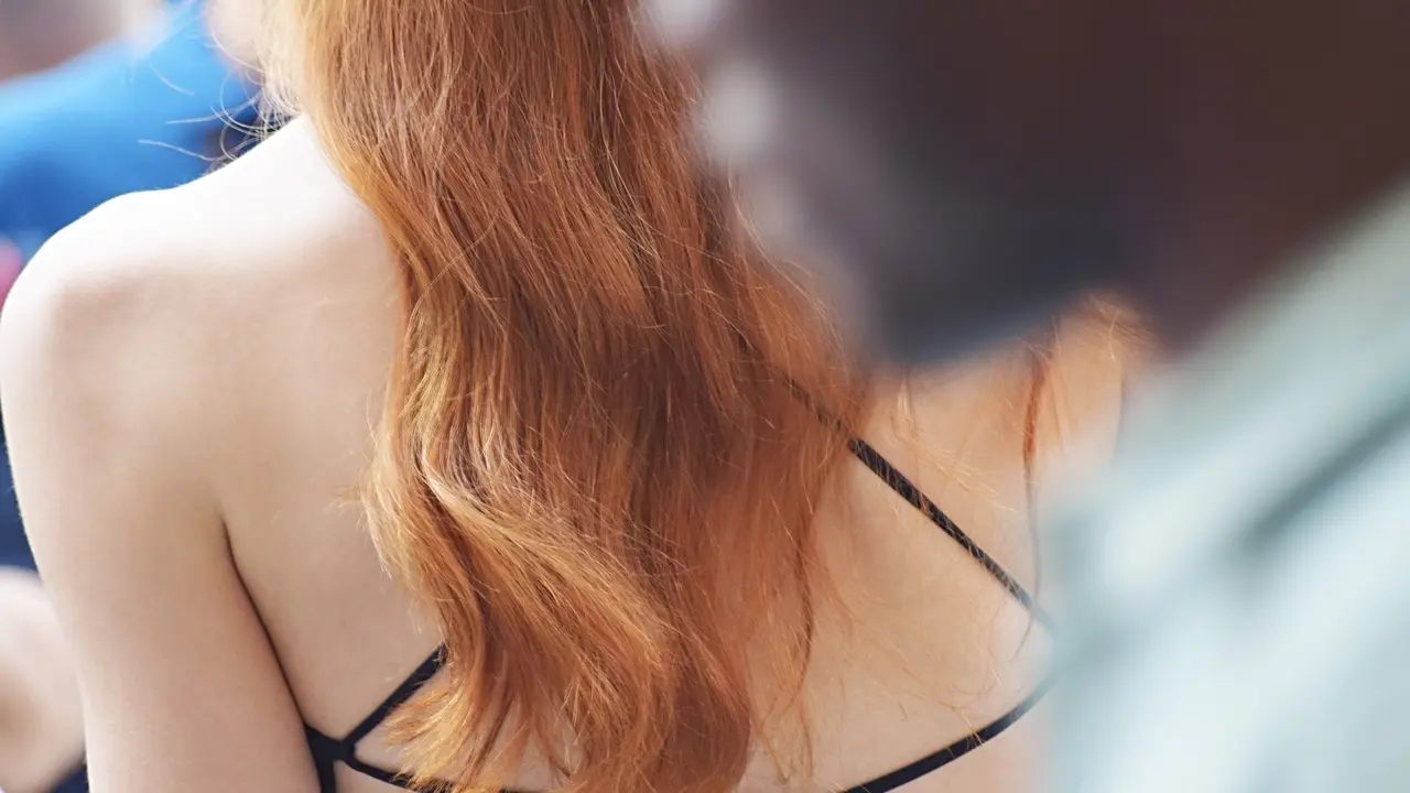 Fungal Acne: Bagaimana Cara Mengenali dan Mengatasinya