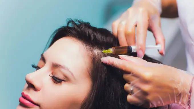 Ilustrasi transplantasi rambut