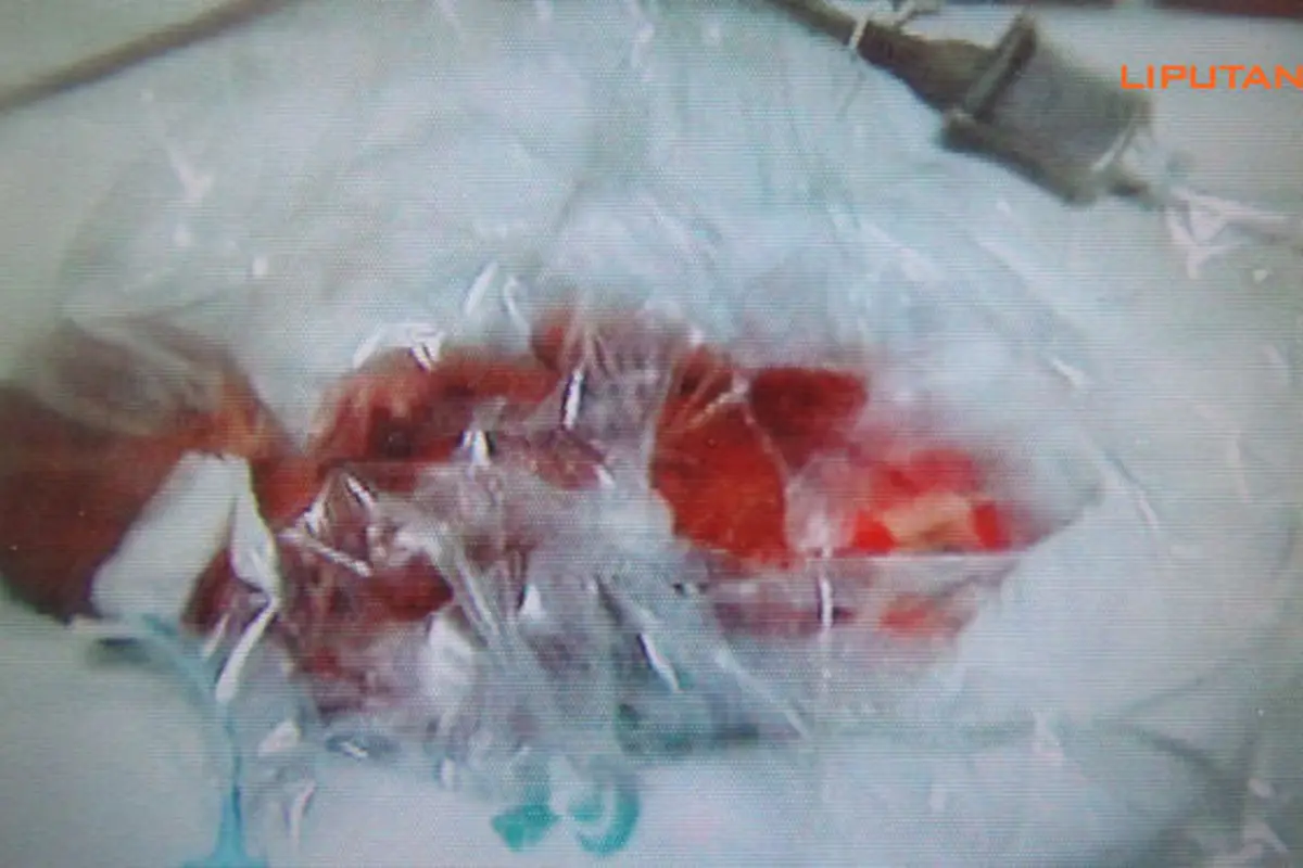 bayi-kembar-lahir-130820b.jpg