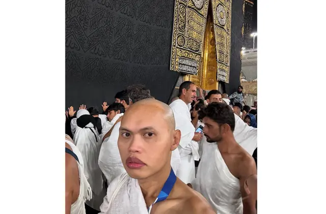 7 Potret Wanda Hara tampil dengan kepala plontos saat umrah, tuai pujian