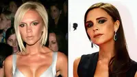 Pengakuan Victoria Beckham Tentang Implan Payudara