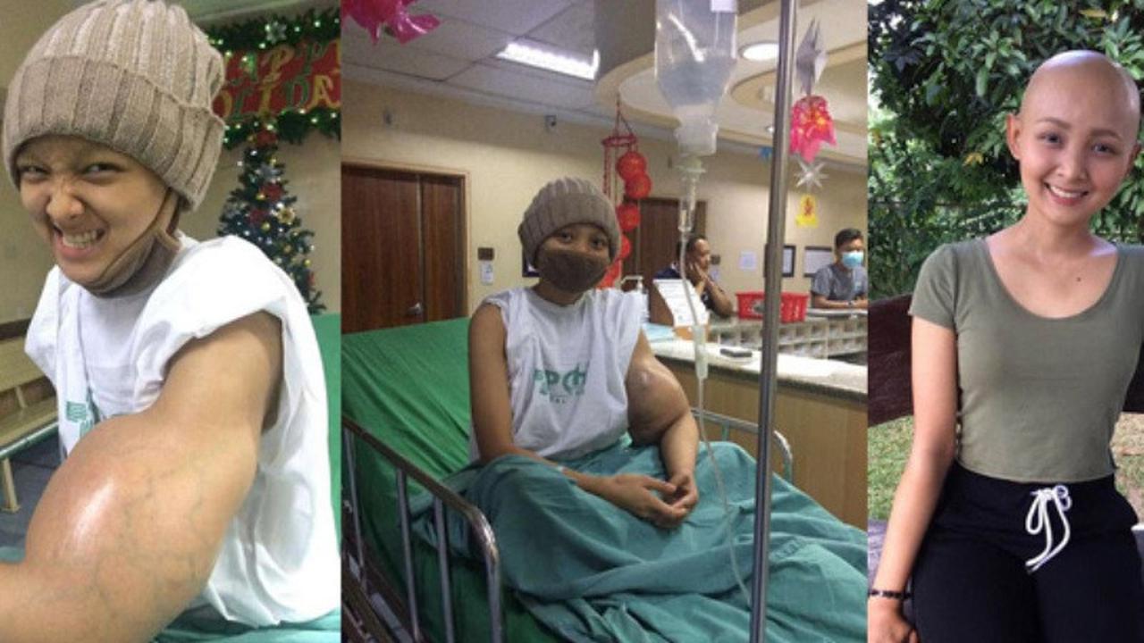 Dikira Gigitan Nyamuk, Benjol di Lengan Gadis Ini Membesar Jadi Kanker Ganas