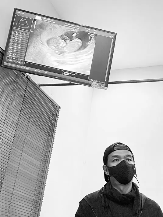 Baby Bump Faradina Mufti Istri Dimas Djay (Instagram/faradinamufti)