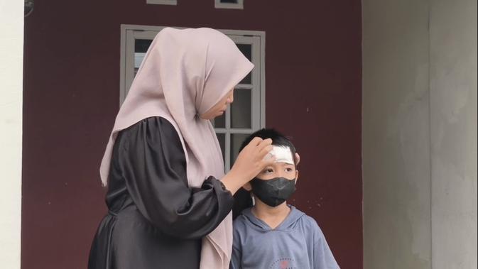 Peluru Nyasar Patahkan Tengkorak Bocah 7 Tahun di Gowa
