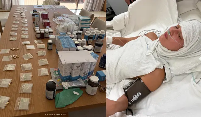 Bella Hadid berjuang lawan penyakit lyme, begini potret terbarunya, obatnya semeja penuh