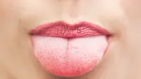 Beberapa gejala kanker lidah ini sering disepelekan oleh si penderita. Kamu juga harus waspada! (Foto: images.medicaldaily.com)