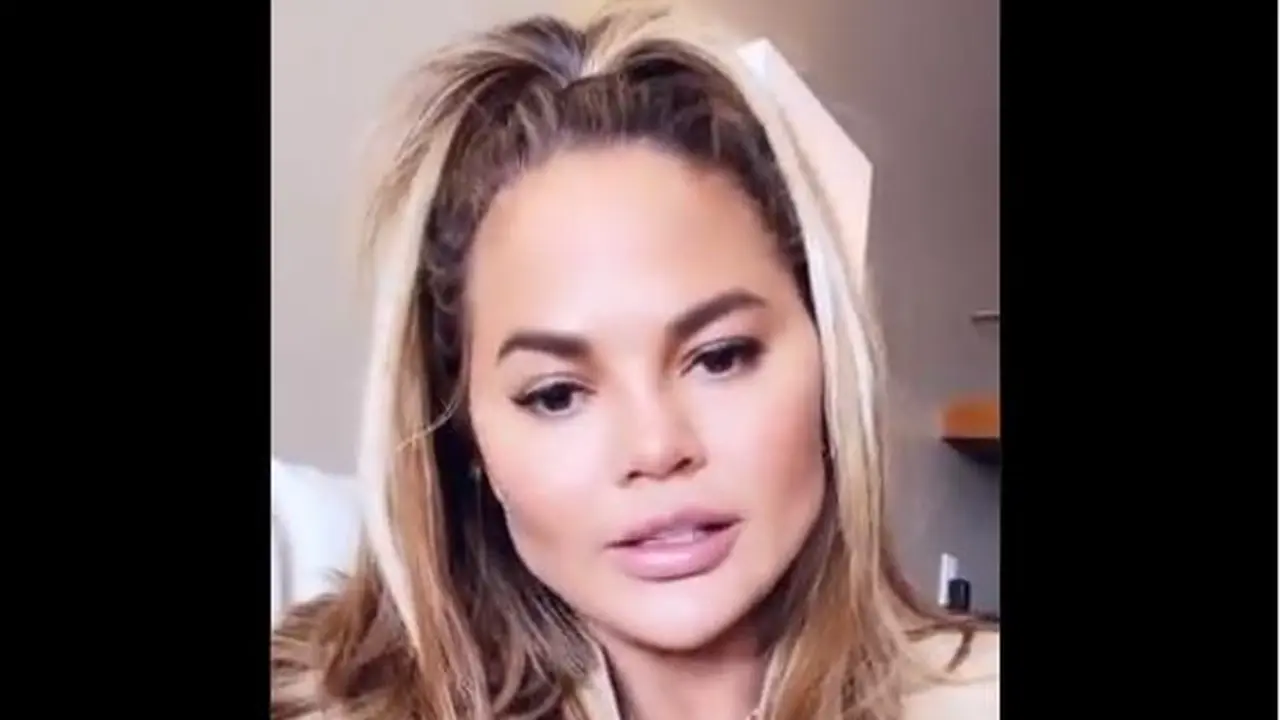 Chrissy Teigen Akui Operasi Pengangkatan Lemak di Pipi