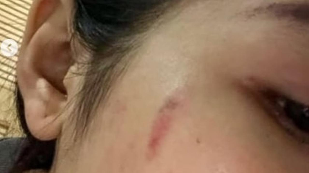 Viral Wanita Cantik Dihajar-Dicekik Polisi Karena Cek DM di Medsos, Punya Bukti Foto Saat Lebam & Berdarah