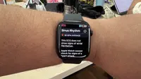 Apple Watch. (Liputan6.com/ Yuslianson)