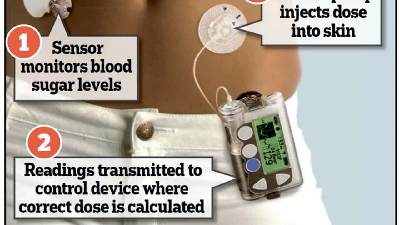 Diabetesi Dapat Gunakan Alat Ini Untuk Hentikan Suntikan Insulin