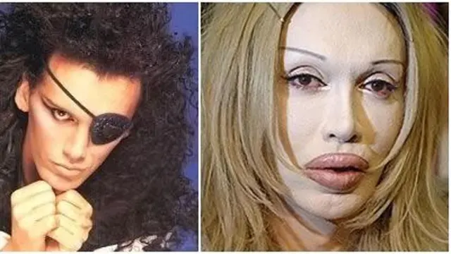 Pete Burns