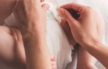 Cara Tepat Menceboki Bayi yang Harus Diperhatikan Orangtua, Cegah Munculnya Masalah Kesehatan