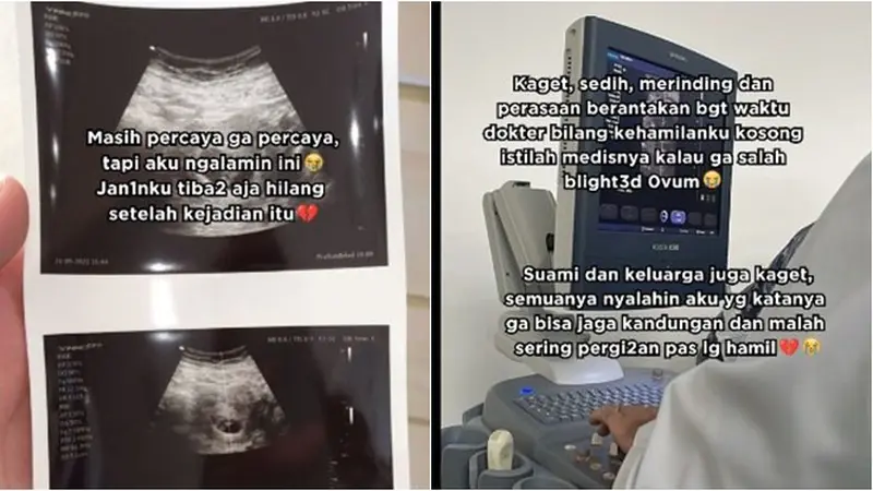 Viral, Ibu Hamil Ini Klaim Janinnya Hilang Usai Bertemu Nenek-Nenek saat Maghrib