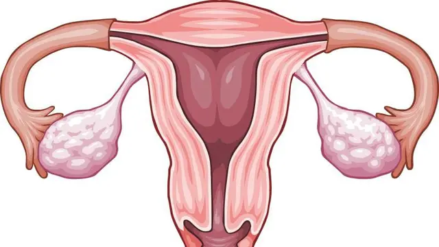 Penebalan Dinding Rahim, Apakah Tanda Awal Kanker?