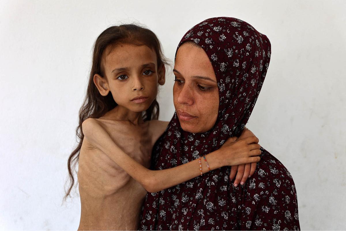 FOTO: Potret Pedih Mariam Anak 9 Tahun, Korban Kelaparan Gaza