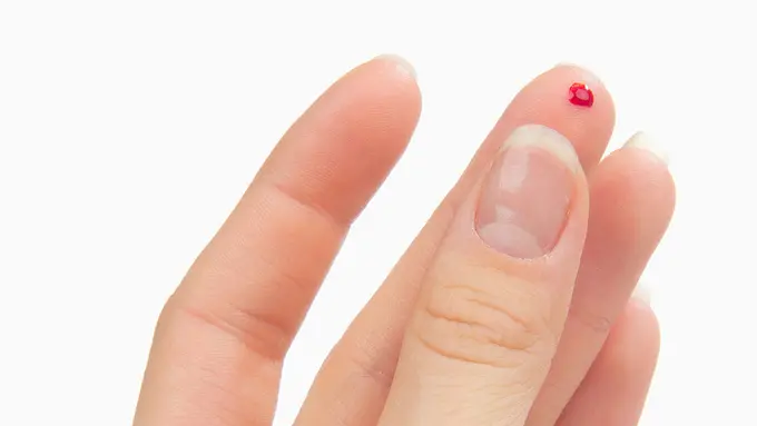 Gunakan Lem untuk Atasi Jarimu yang Tergores Benda Tajam