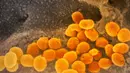 Gambar menggunakan mikroskop elektron yang tak bertanggal pada Februari 2020 menunjukkan virus corona SARS-CoV-2 (oranye) muncul dari permukaan sel (abu-abu) yang dikultur di laboratorium.  Sampel virus dan sel diambil dari seorang pasien yang terinfeksi COVID-19. (NIAID-RML via AP)