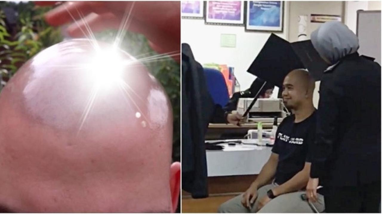 Punya Kepala Botak, Pria Ini Perlu Alat Bantu Saat Foto Paspor